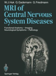 Magnetic Resonance Imaging of Central Nervous System Diseases