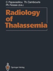 Radiology of Thalassemia