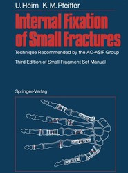 Internal Fixation of Small Fractures