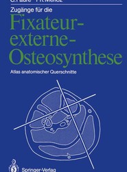 Zugange fur die Fixateur-externe-Osteosynthese
