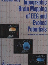 Topographic Brain Mapping of EEG and Evoked Potentials