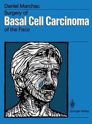 Surgery of Basal Cell Carcinoma of the Face