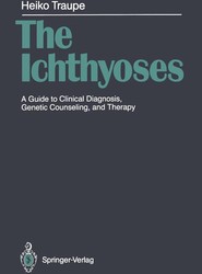 The Ichthyoses