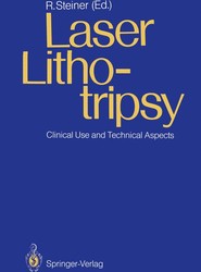 Laser Lithotripsy