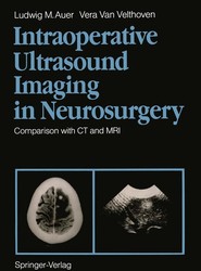 Intraoperative Ultrasound Imaging in Neurosurgery