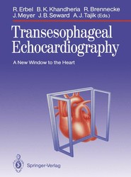Transesophageal Echocardiography