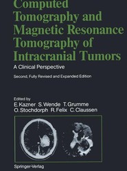 Computed Tomography and Magnetic Resonance Tomography of Intracranial Tumors