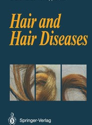 Hair and Hair Diseases