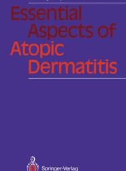 Essential Aspects of Atopic Dermatitis