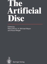The Artificial Disc