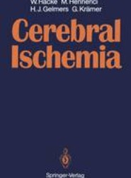 Cerebral Ischemia