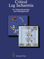 Critical Leg Ischaemia