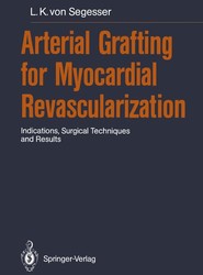 Arterial Grafting for Myocardial Revascularization