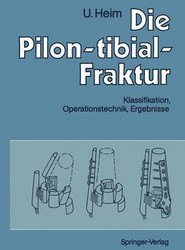 Die Pilon-tibial-Fraktur