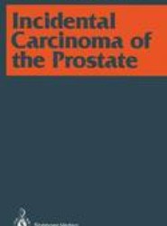 Incidental Carcinoma of the Prostate