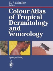 Colour Atlas of Tropical Dermatology and Venerology
