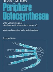 Periphere Osteosynthesen