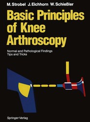 Basic Principles of Knee Arthroscopy