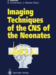 Imaging Techniques of the CNS of the Neonates