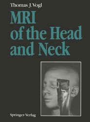 MRI of the Head and Neck