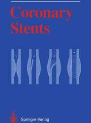 Coronary Stents