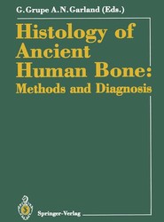 Histology of Ancient Human Bone: Methods and Diagnosis