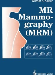 MR Mammography (MRM)