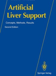 Artificial Liver Support