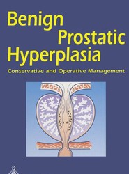 Benign Prostatic Hyperplasia