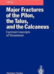 Major Fractures of the Pilon, the Talus, and the Calcaneus