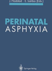 Perinatal Asphyxia