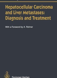 Hepatocellular Carcinoma and Liver Metastases: Diagnosis and Treatment