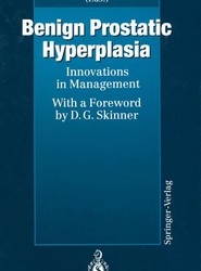 Benign Prostatic Hyperplasia