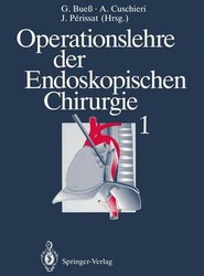Operationslehre der Endoskopischen Chirurgie 1