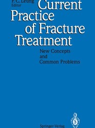 Current Practice of Fracture Treatment