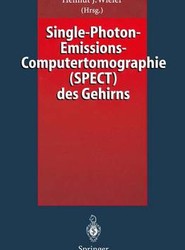 Single-Photon-Emissions-Computertomographie (SPECT) des Gehirns