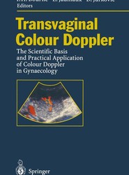 Transvaginal Colour Doppler