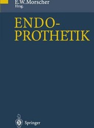 Endoprothetik