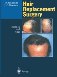Hair Replacement Surgery