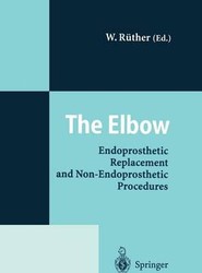 The Elbow