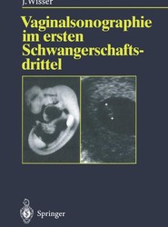 Vaginalsonographie im ersten Schwangerschaftsdrittel
