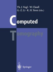 Computed Tomography