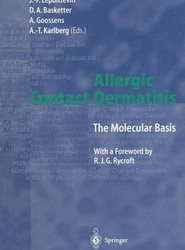 Allergic Contact Dermatitis