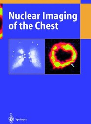 Nuclear Imaging of the Chest