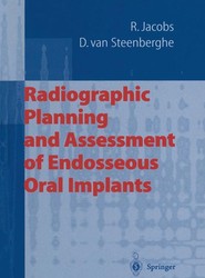 Radiographic Planning and Assessment of Endosseous Oral Implants