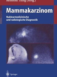 Mammakarzinom