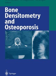 Bone Densitometry and Osteoporosis