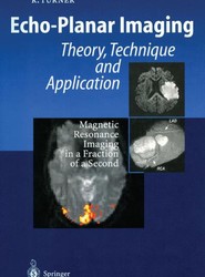 Echo-Planar Imaging