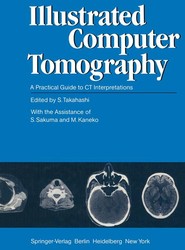 Illustrated Computer Tomography