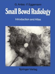 Small Bowel Radiology